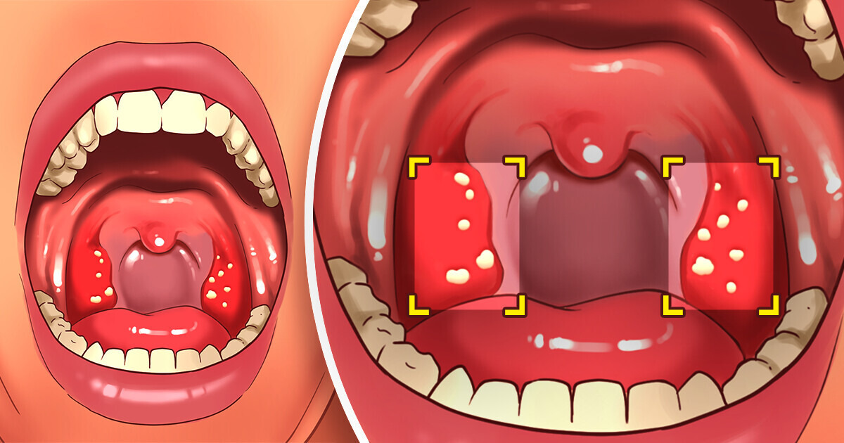 10 Simple Ways to Keep Your Teeth Healthy