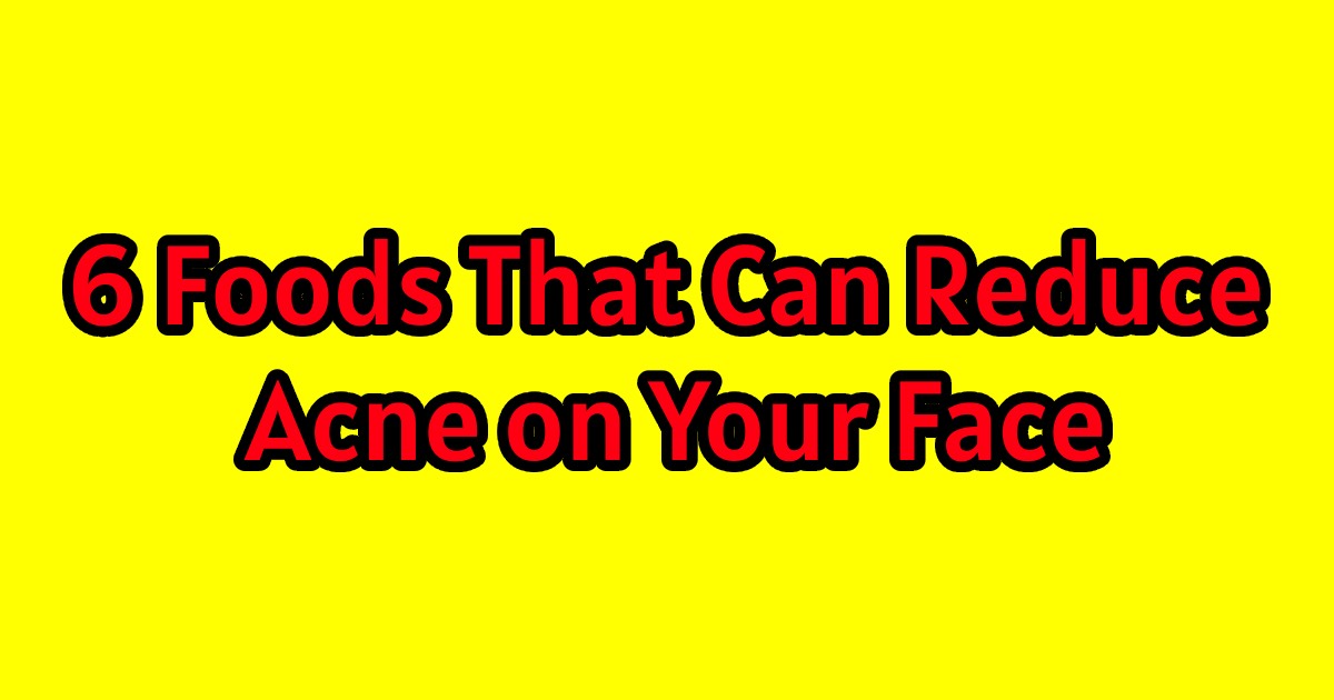 6 Foods That Can Reduce Acne on Your Face